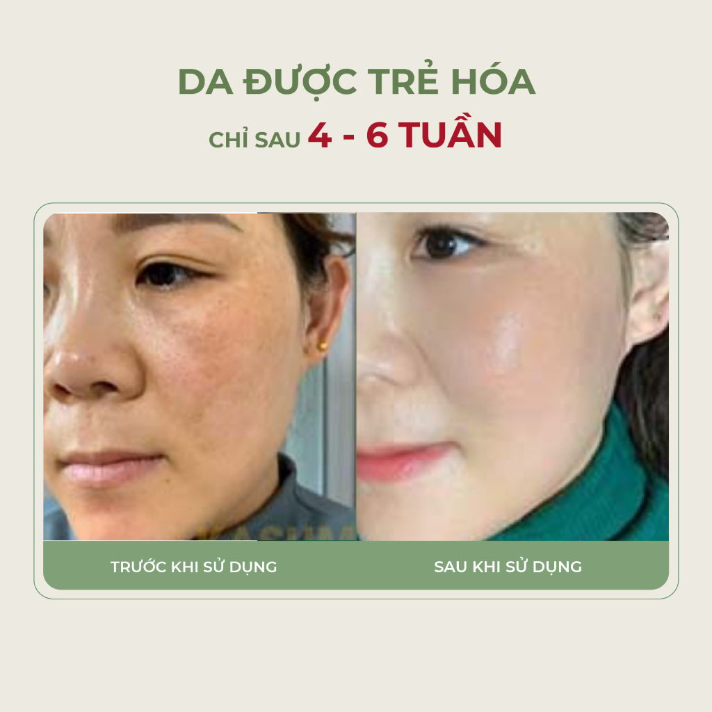 Hiệu quả trước sau